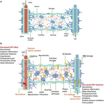 Dysfunction of the Glymphatic System as a Potential Mechanism of Perioperative Neurocognitive Disorders